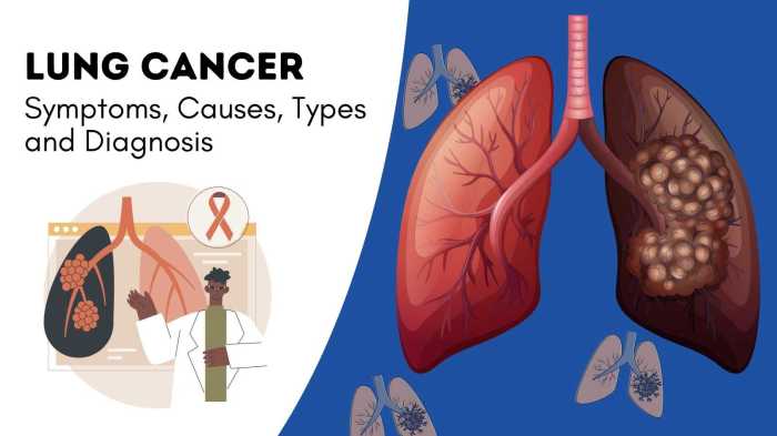 Lung cancer symptoms